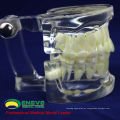 DENTAL11 (12571) Humano Adulto Natural Tamanho Transparente Padrão Dental Ensinar Modelos